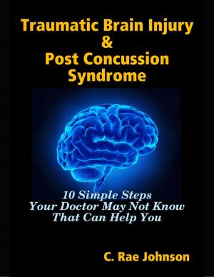 Book cover of Traumatic Brain Injury & Post Concussion Syndrome - 10 Simple Steps Your Doctor May Not Know That Can Help You