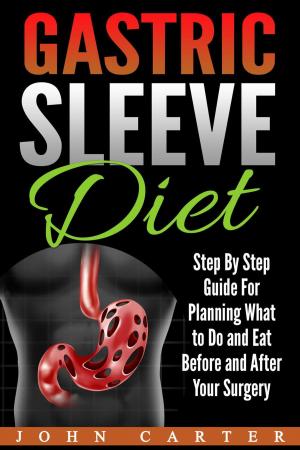 Cover of Gastric Sleeve Diet: Step By Step Guide For Planning What to Do and Eat Before and After Your Surgery
