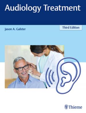 Cover of the book Audiology Treatment by Jaime Tisnado, Rao Ivatury