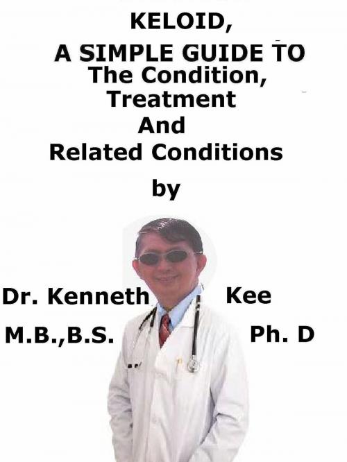 Cover of the book Keloid, A Simple Guide to The Condition, Treatment And Related Conditions by Kenneth Kee, Kenneth Kee