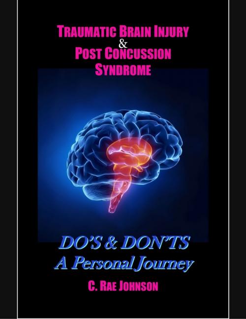 Cover of the book Traumatic Brain Injury & Post Concussion Syndrome:Do's & Dont's A Personal Journey by C. Rae Johnson, Lulu.com