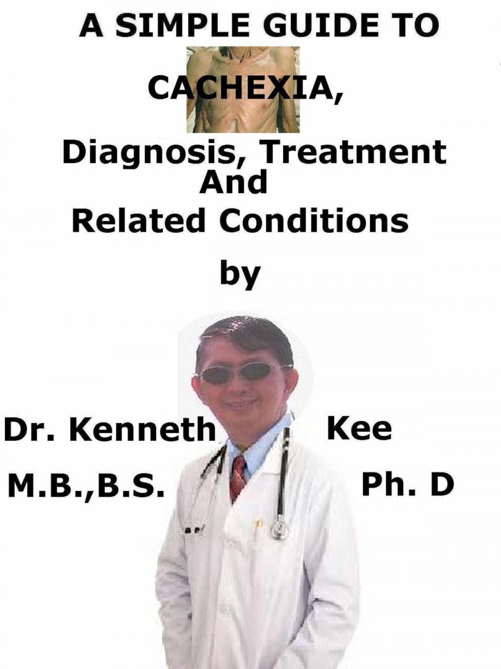 Big bigCover of A Simple Guide To Cachexia, Diagnosis, Treatment And Related Conditions