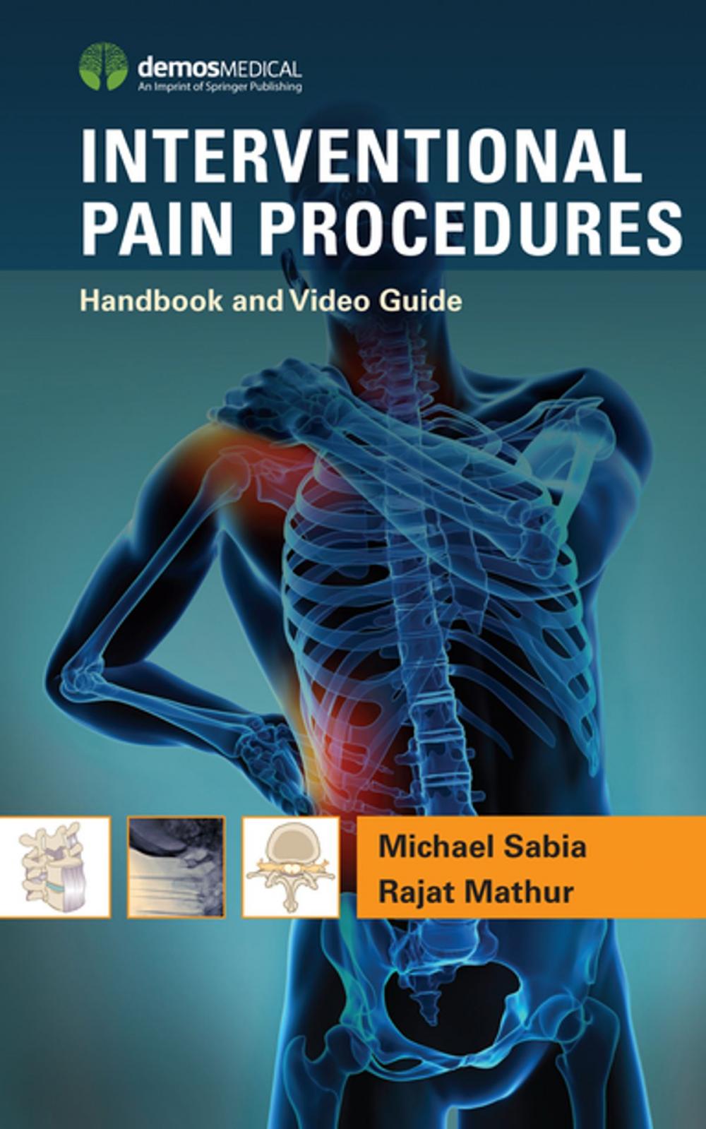 Big bigCover of Interventional Pain Procedures