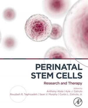Cover of the book Perinatal Stem Cells by Allen I. Laskin, Geoffrey M. Gadd, Sima Sariaslani
