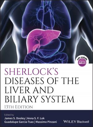 Cover of the book Sherlock's Diseases of the Liver and Biliary System by Jürgen Weber, Christian Krügerke, Andreas Linnenlücke