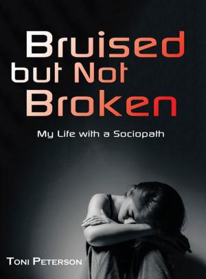 Cover of the book Bruised but Not Broken by Rachel Renee