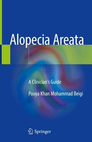 Book cover of Alopecia Areata