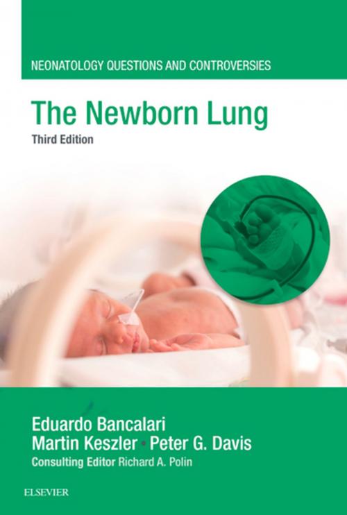 Cover of the book The Newborn Lung by Eduardo Bancalari, MD, Elsevier Health Sciences