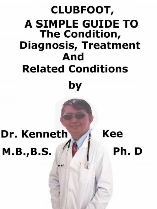 Cover of the book Clubfoot, A Simple Guide To The Condition, Diagnosis, Treatment And Related Conditions by Kenneth Kee, Kenneth Kee