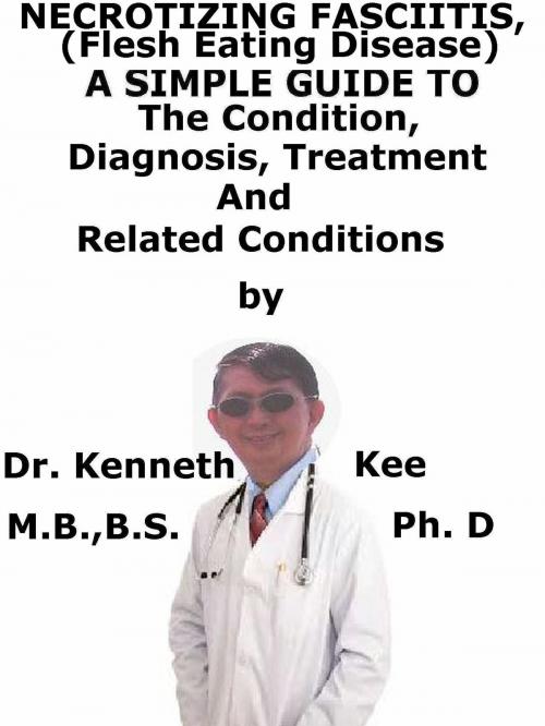 Cover of the book Necrotizing Fasciitis, (Flesh Eating Disease) A Simple Guide To The Condition, Diagnosis, Treatment And Related Conditions by Kenneth Kee, Kenneth Kee