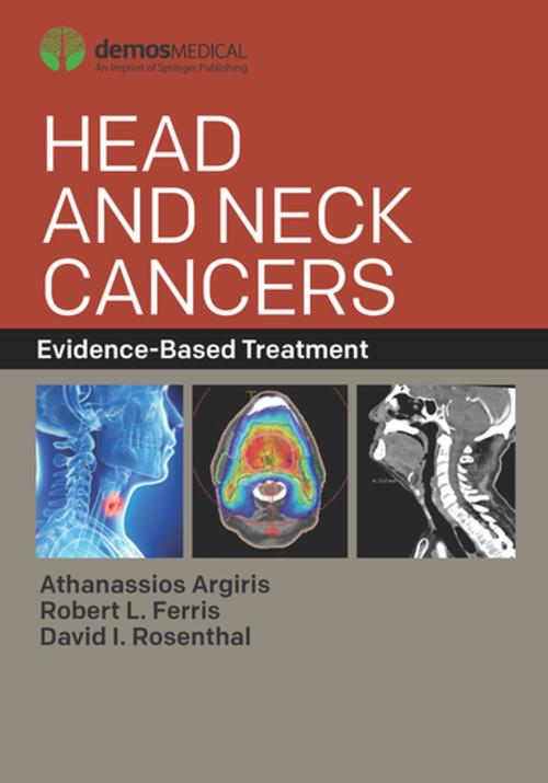 Cover of the book Head and Neck Cancers by , Springer Publishing Company