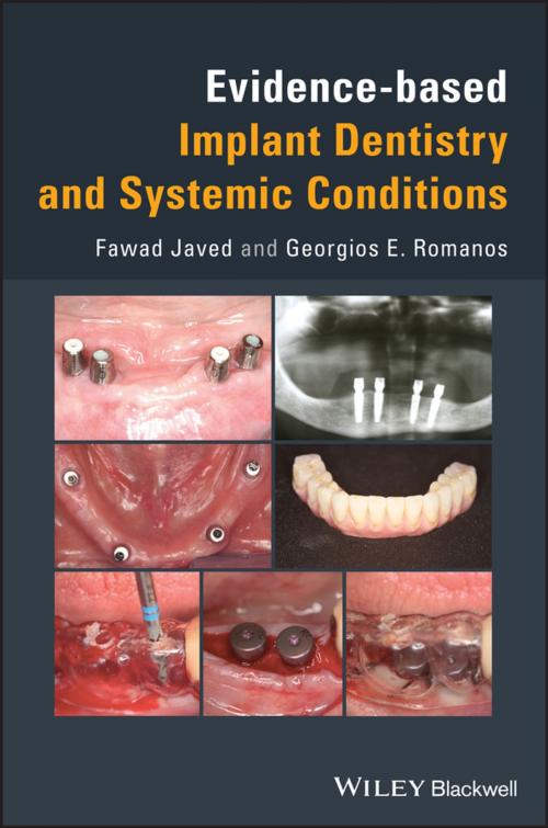Cover of the book Evidence-based Implant Dentistry and Systemic Conditions by Javed, Georgios E. Romanos, Wiley