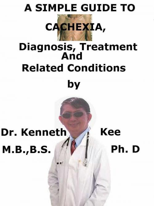 Cover of the book A Simple Guide To Cachexia, Diagnosis, Treatment And Related Conditions by Kenneth Kee, Kenneth Kee