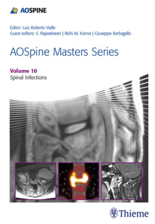 Cover of the book AOSpine Masters Series, Volume 10: Spinal Infections by Luiz Roberto Vialle, Thieme