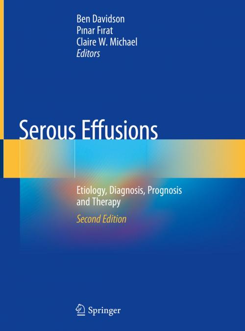 Cover of the book Serous Effusions by , Springer International Publishing