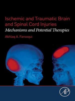 Book cover of Ischemic and Traumatic Brain and Spinal Cord Injuries