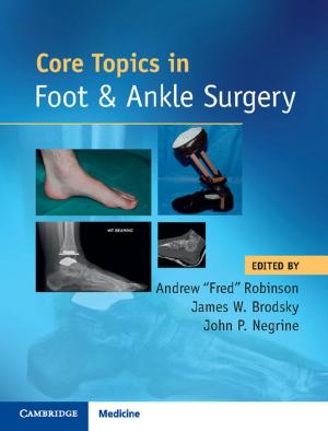 Cover of the book Core Topics in Foot and Ankle Surgery by Stephen Kates, Olivier Borens