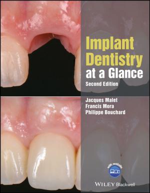 Cover of the book Implant Dentistry at a Glance by Ruth C. Clark, Richard E. Mayer