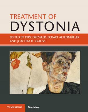 Cover of the book Treatment of Dystonia by Kevin J. Vanhoozer