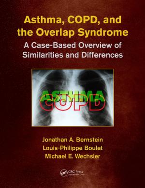 Cover of the book Asthma, COPD, and Overlap by Sari Gilbert