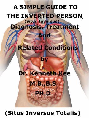 Cover of the book A Simple Guide To The Inverted Person, (Situs Inversus) Diagnosis, Treatment And Related Conditions by Sara Davenport