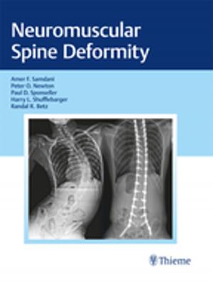 Cover of the book Neuromuscular Spine Deformity by Hildegard Wittlinger, Dieter Wittlinger, Andreas Wittlinger
