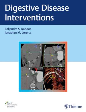 Book cover of Digestive Disease Interventions