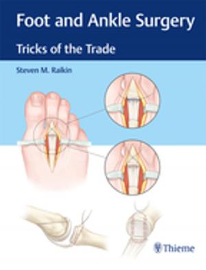 Cover of the book Foot and Ankle Surgery by Isabelle M. Germano