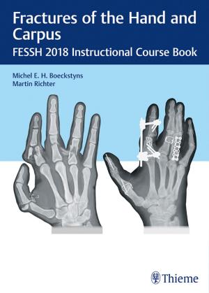 Cover of the book Fractures of the Hand and Carpus by Michael B. Zimmermann