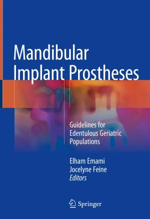 Cover of the book Mandibular Implant Prostheses by Annika Steiber