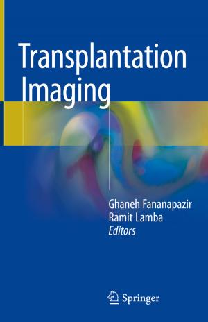 Cover of the book Transplantation Imaging by Jie Kang