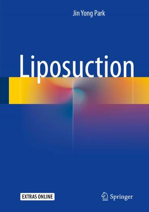Cover of the book Liposuction by Jianxiong Ge, Angang Hu, Yifu Lin, Liang Qiao