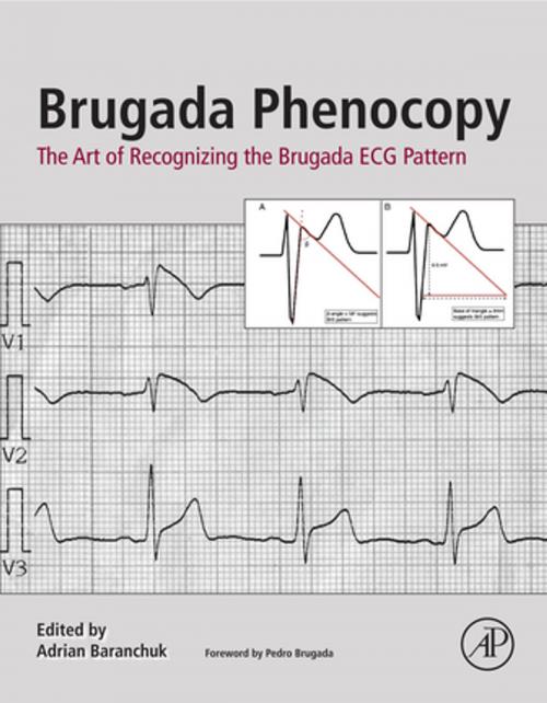 Cover of the book Brugada Phenocopy by , Elsevier Science