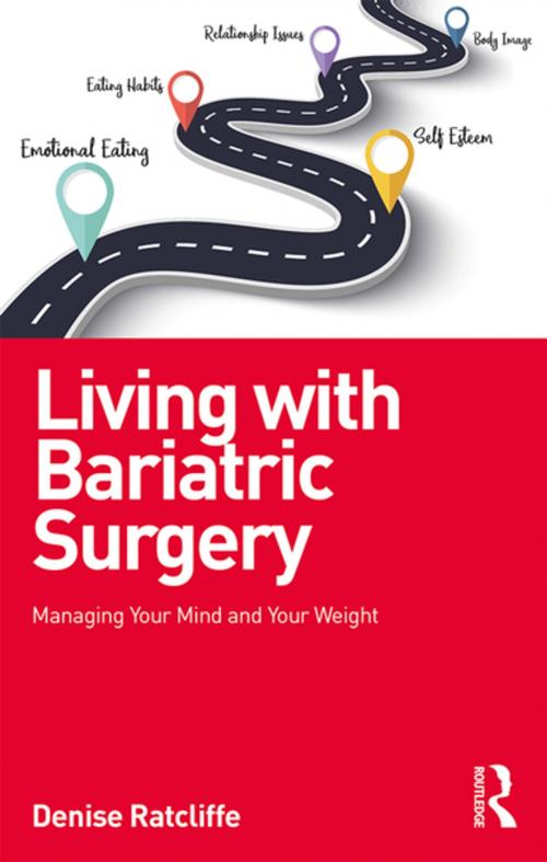Cover of the book Living with Bariatric Surgery by Denise Ratcliffe, Taylor and Francis