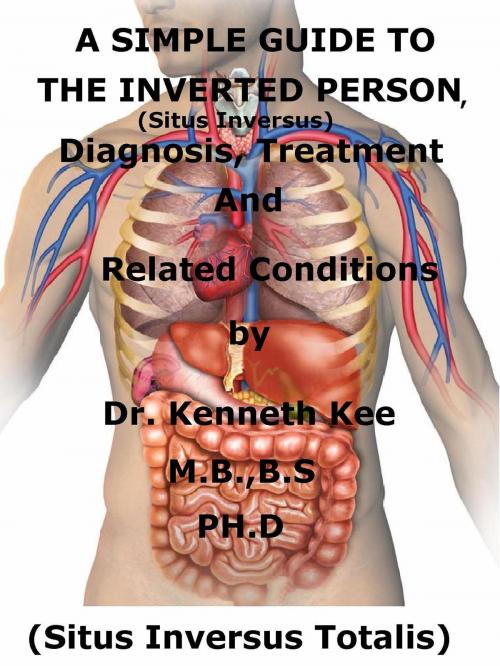 Cover of the book A Simple Guide To The Inverted Person, (Situs Inversus) Diagnosis, Treatment And Related Conditions by Kenneth Kee, Kenneth Kee