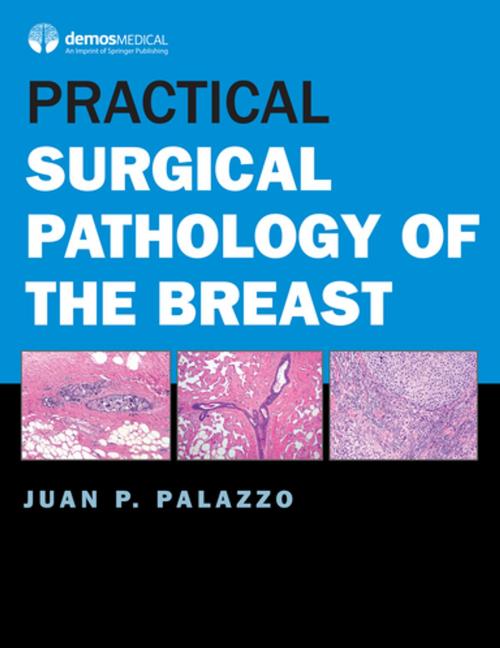 Cover of the book Practical Surgical Pathology of the Breast by Juan P. Palazzo, MD, Springer Publishing Company