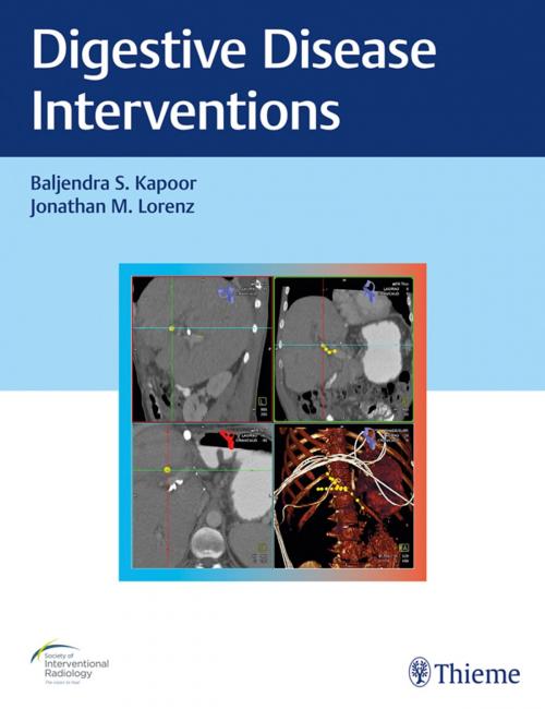 Cover of the book Digestive Disease Interventions by Baljendra S. Kapoor, Jonathan M. Lorenz, Thieme