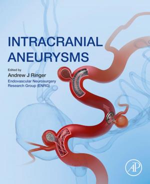 Cover of the book Intracranial Aneurysms by Fred Gifford, John Woods, Dov M. Gabbay, Paul Thagard