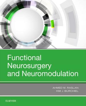Cover of the book Functional Neurosurgery and Neuromodulation by Rhonda Nay, RN, PhD, FRCNA FCN(NSW), Sally Garratt, RN, CertMidwifery, DipAppSc(NursEd), MScN, FRCNA, Deirdre Fetherstonhaugh