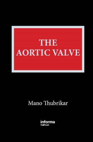 Cover of the book The Aortic Valve by 