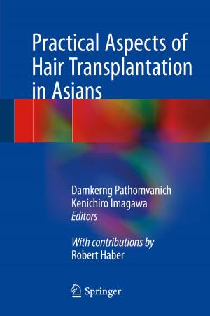 Cover of the book Practical Aspects of Hair Transplantation in Asians by Michihiro Ohyama