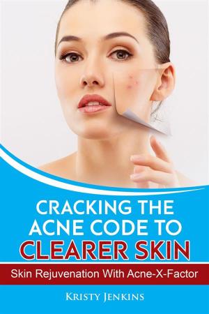 Book cover of Cracking the Acne Code to Clearer Skin
