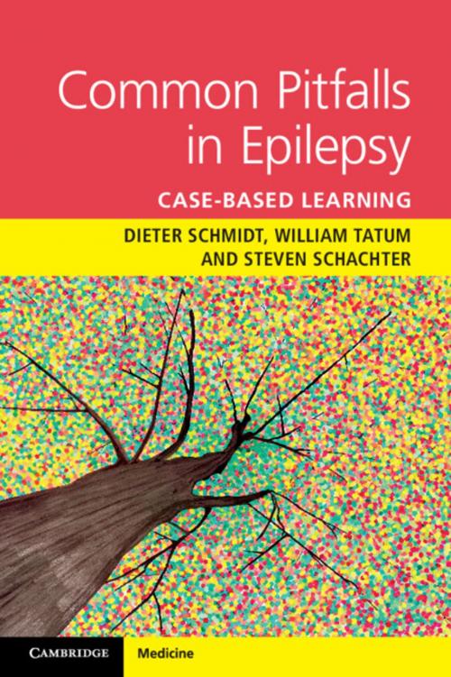 Cover of the book Common Epilepsy Pitfalls by Dieter Schmidt, Steven Schachter, Cambridge University Press