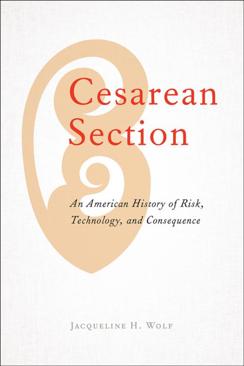 Cover of the book Cesarean Section by Jacqueline H. Wolf, Johns Hopkins University Press
