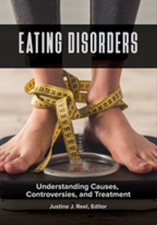 Cover of the book Eating Disorders: Understanding Causes, Controversies, and Treatment [2 volumes] by , ABC-CLIO