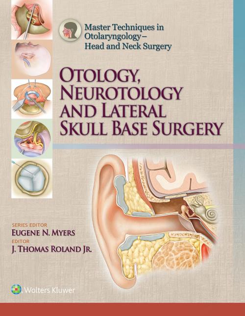 Cover of the book Master Techniques in Otolaryngology – Head and Neck Surgery by J. Thomas Roland, Jr., Wolters Kluwer Health