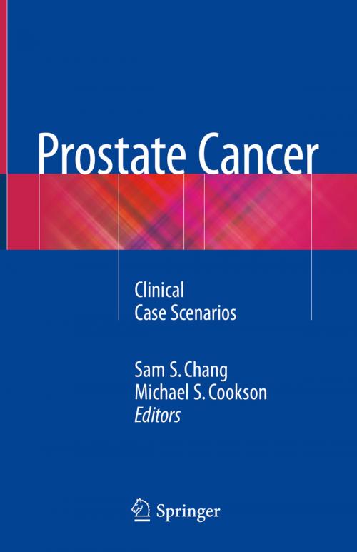 Cover of the book Prostate Cancer by , Springer International Publishing