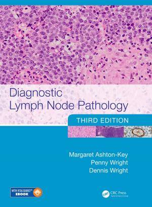 Cover of the book Diagnostic Lymph Node Pathology by David Allan Bradley, Derek Seward, David Dawson, Stuart Burge
