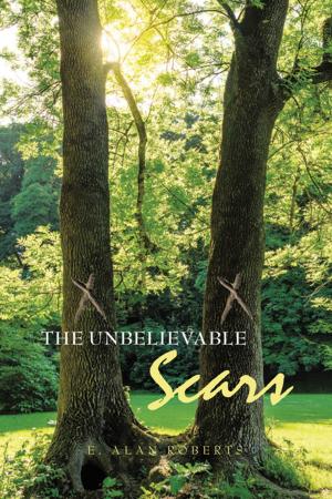 bigCover of the book The Unbelievable Scars by 