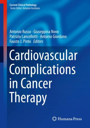 Cover of the book Cardiovascular Complications in Cancer Therapy by Riccardo Rovatti, Mauro Mangia, Valerio Cambareri, Gianluca Setti, Fabio Pareschi